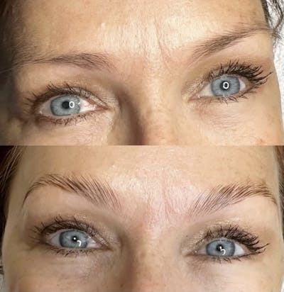 Brow Lamination  Before & After Gallery - Patient 169045 - Image 1