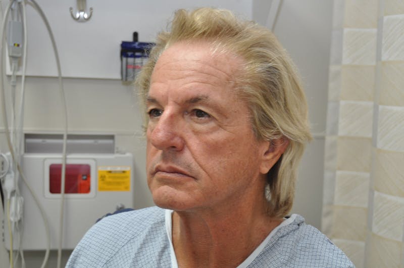 Blepharoplasty Before & After Gallery - Patient 346033 - Image 5