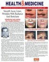Smooth Away Lines, Wrinkles with Radiance And Restylane