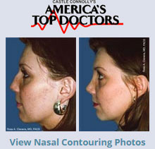 Nasal Contouring