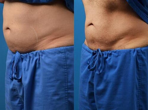 Before & After