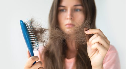 Hair Loss in Women: Causes, Symptoms, and Treatments