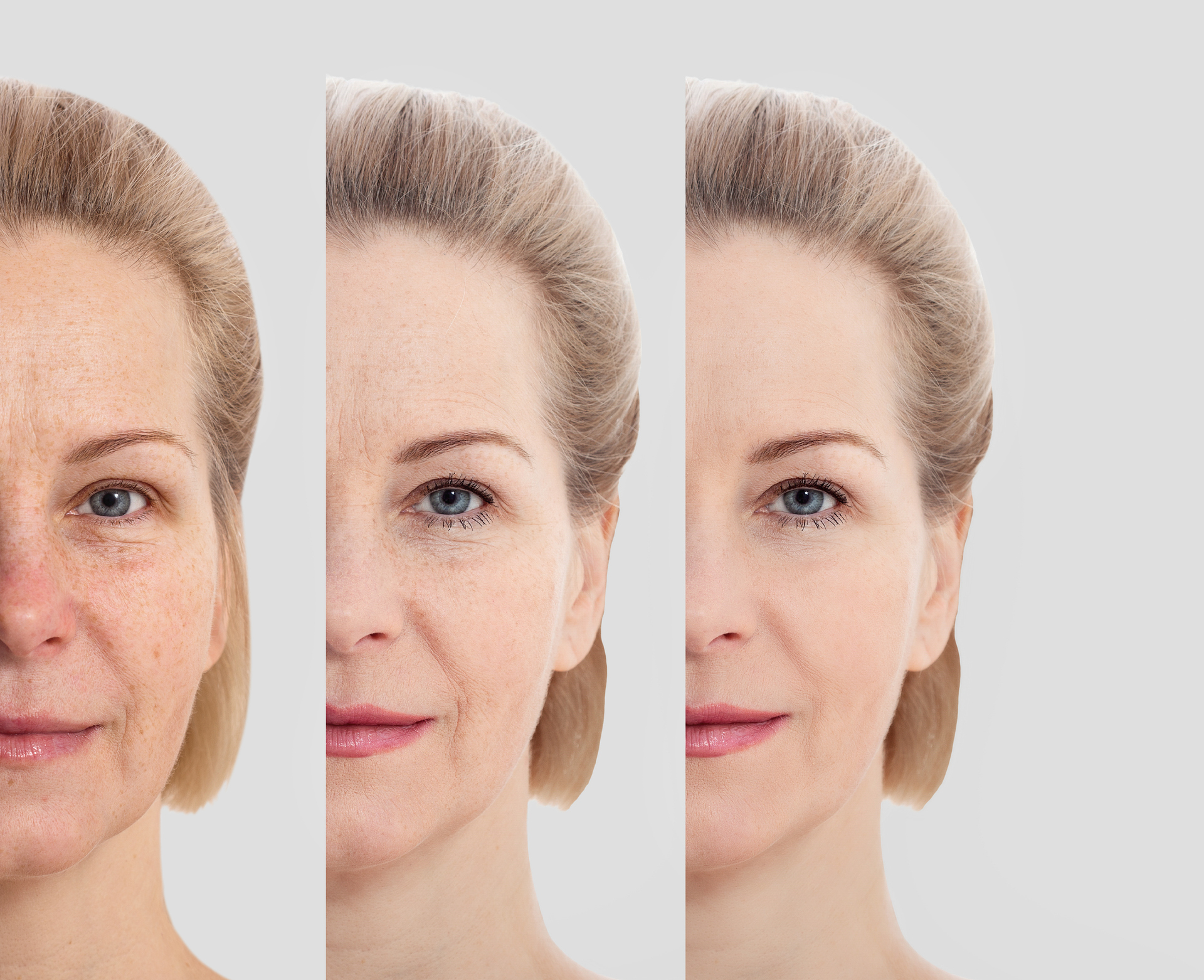 Weight Loss And Facial Features: The Nose'S Surprising Story - refqkqg