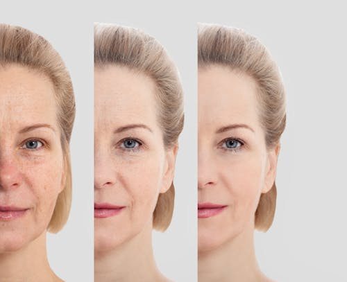 Three images of a woman looking younger as the images progress