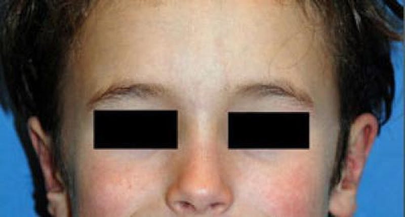 Male Procedures by Dr. Hess Before & After Gallery - Patient 286274 - Image 2