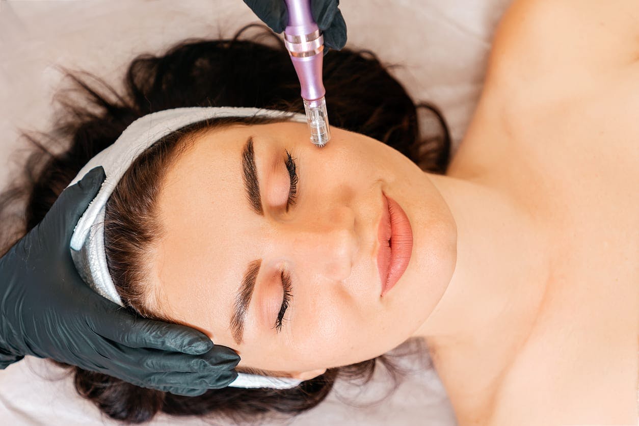 Woman receiving junera treatment
