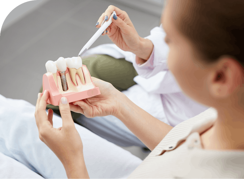 model of dental implants burbank