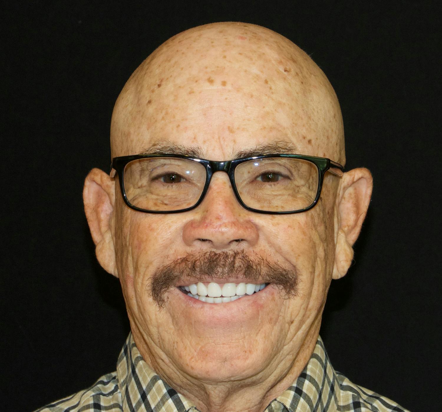 man before and after multiple dental implants in Burbank