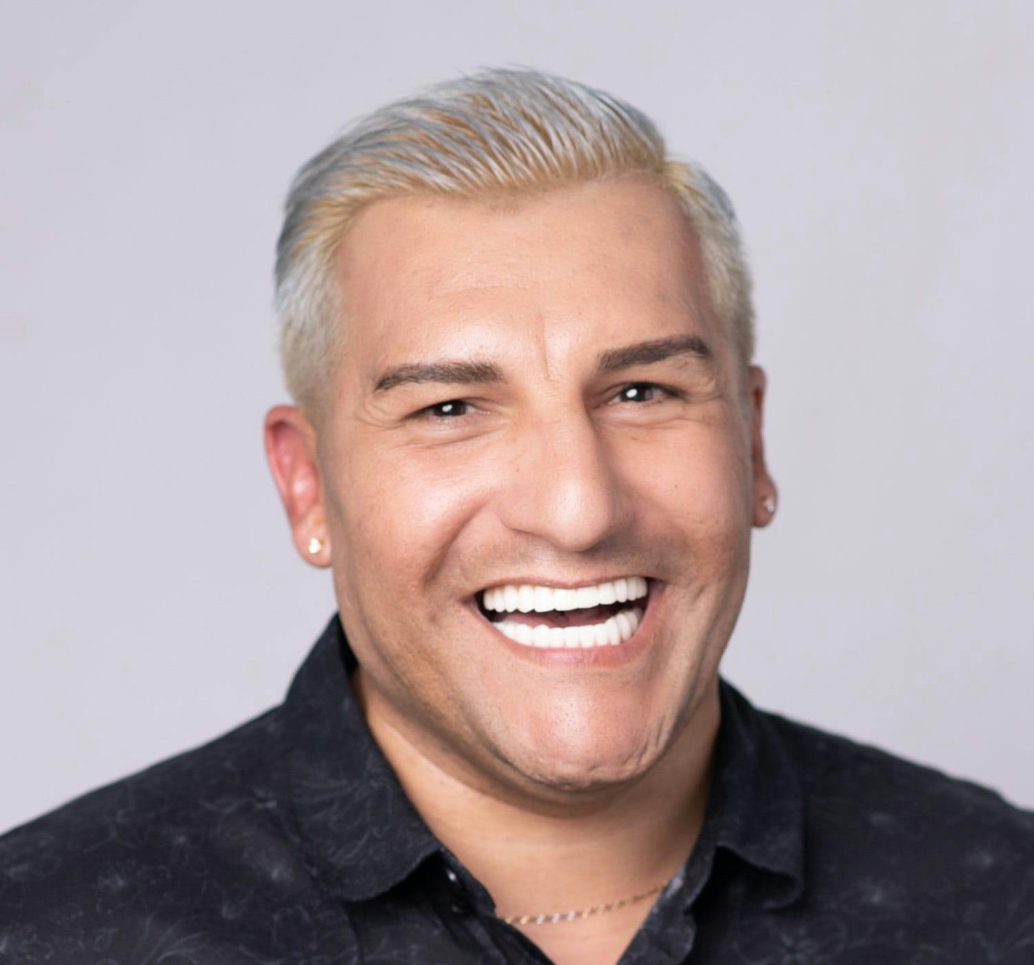 dental implants before and after