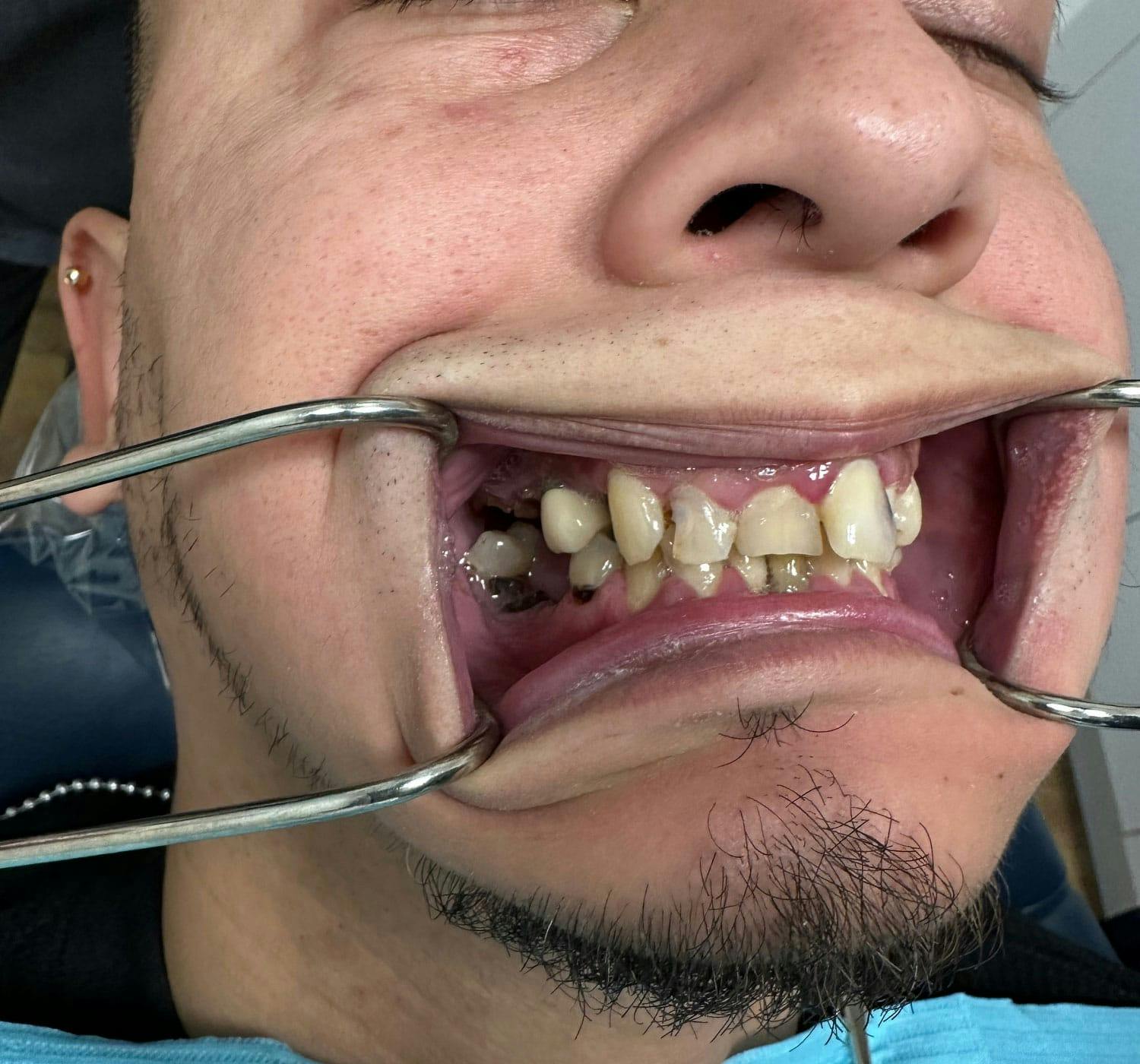 smile-on-4