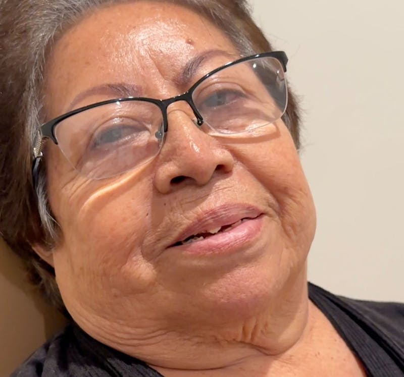 All Before & After Gallery - Patient 216421 - Image 1