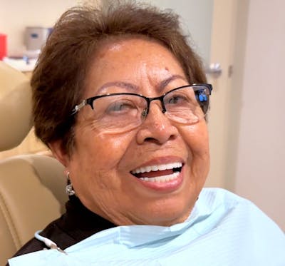 All Before & After Gallery - Patient 216421 - Image 2