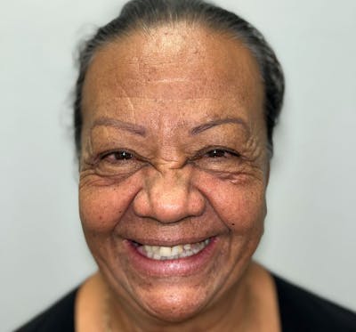 All Before & After Gallery - Patient 210974 - Image 1
