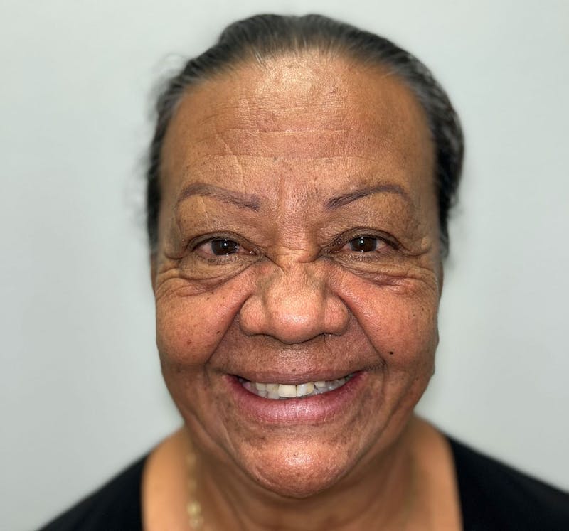 All Before & After Gallery - Patient 210974 - Image 3