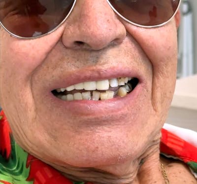 All Before & After Gallery - Patient 329208 - Image 1