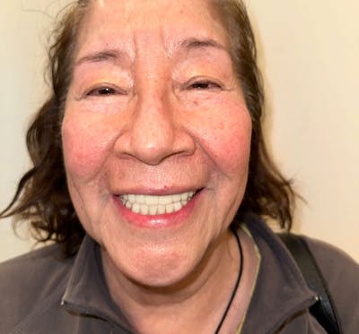 All Before & After Gallery - Patient 192016 - Image 2