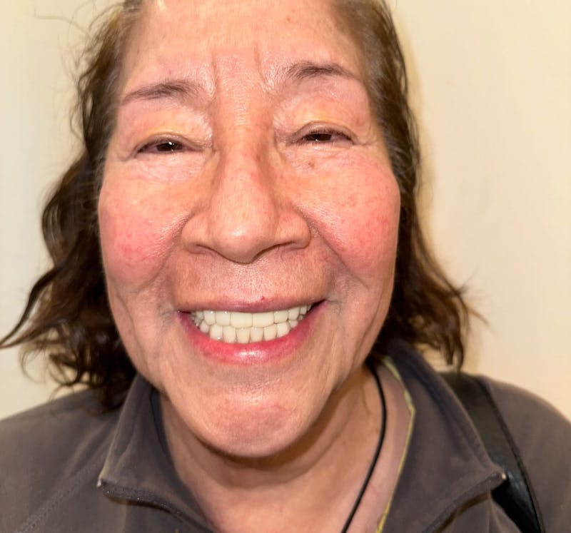 All Before & After Gallery - Patient 192016 - Image 2