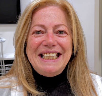 All Before & After Gallery - Patient 101272 - Image 1