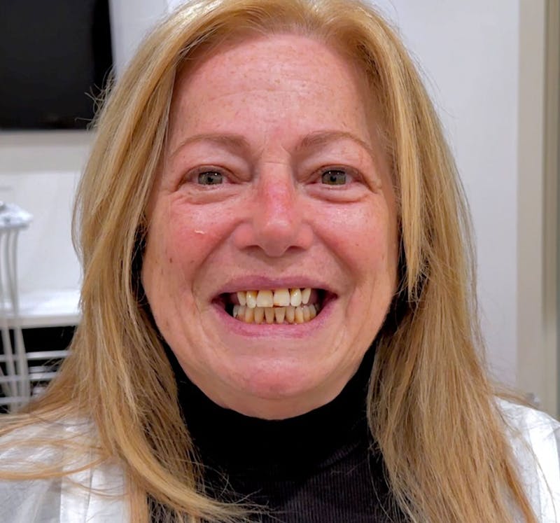 All Before & After Gallery - Patient 101272 - Image 1