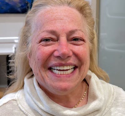 All Before & After Gallery - Patient 101272 - Image 2