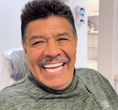 All Before & After Gallery - Patient 424444 - Image 2
