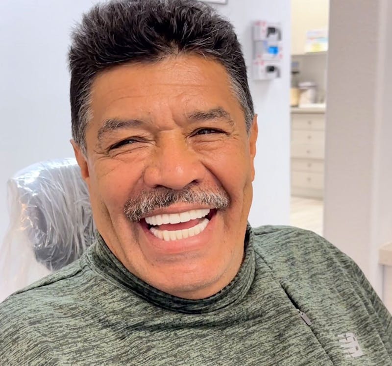 All Before & After Gallery - Patient 424444 - Image 2