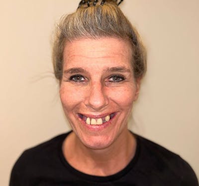 All Before & After Gallery - Patient 368772 - Image 1
