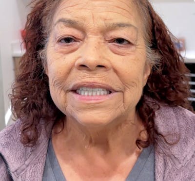 All Before & After Gallery - Patient 359014 - Image 2