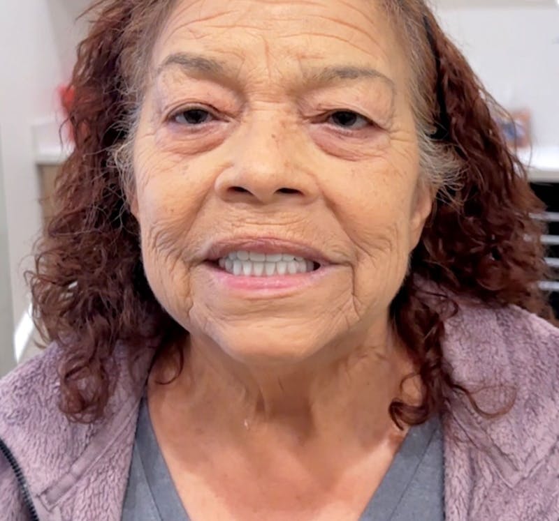 All Before & After Gallery - Patient 359014 - Image 2
