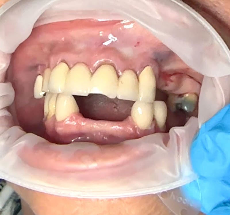 All Before & After Gallery - Patient 359014 - Image 1