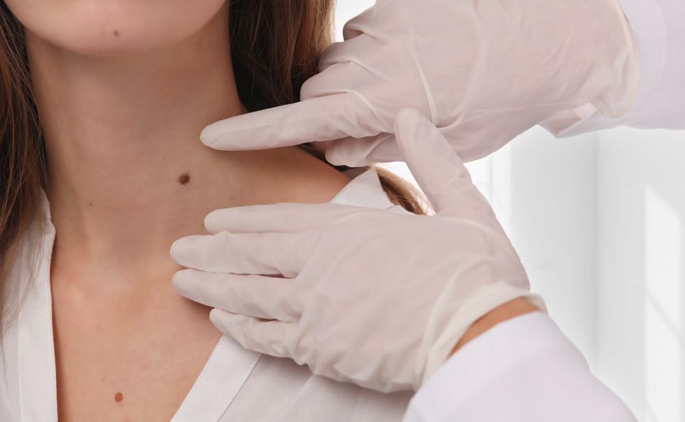 Post Mohs Surgery Complications