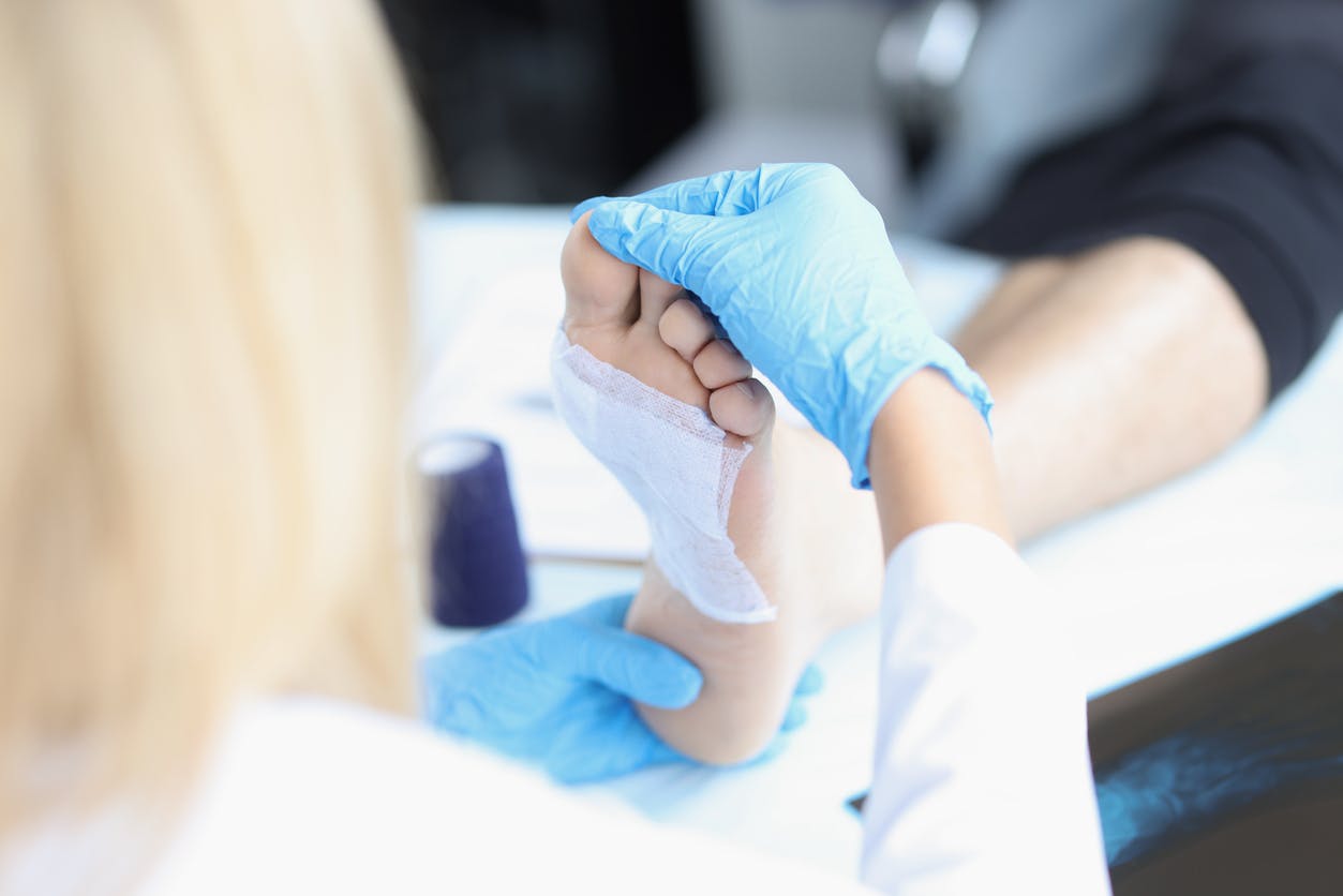 Nurse treating patient's foot