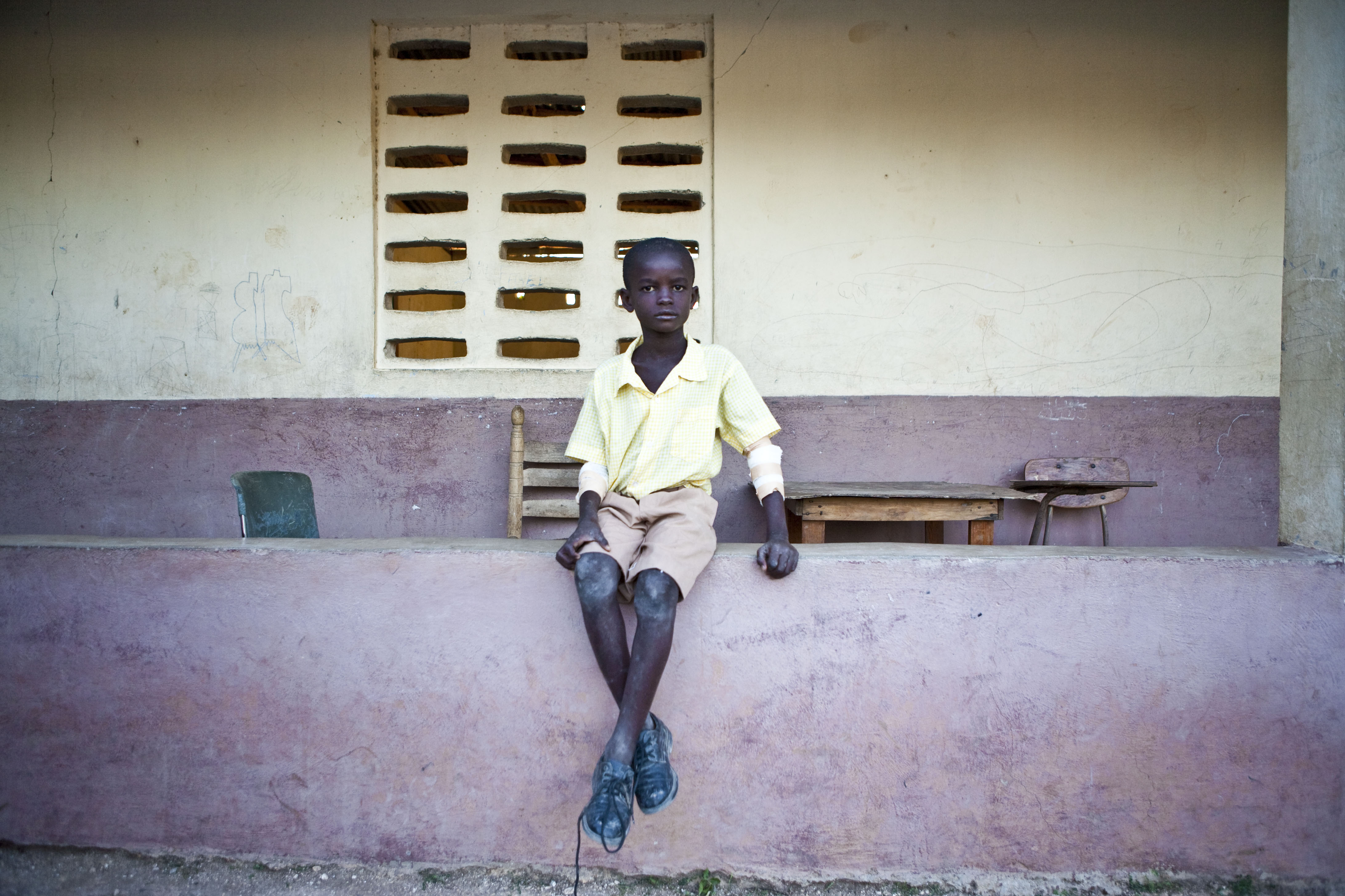 A young patient is photographed shortly after seeing a doctor in a village outside of Port-au-Prince. Nearly 40 percent of the population of Haiti is under 15 years of age.
