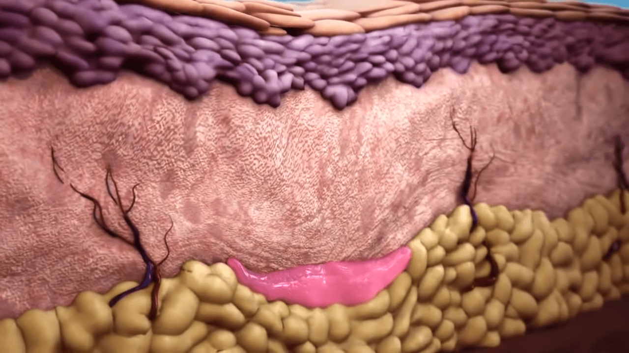 Sculptra Video