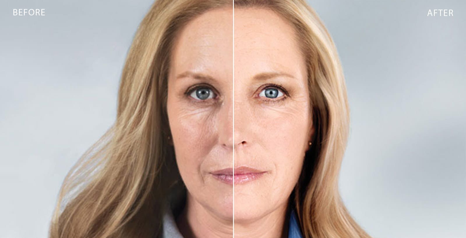 Sculptura - Before and After