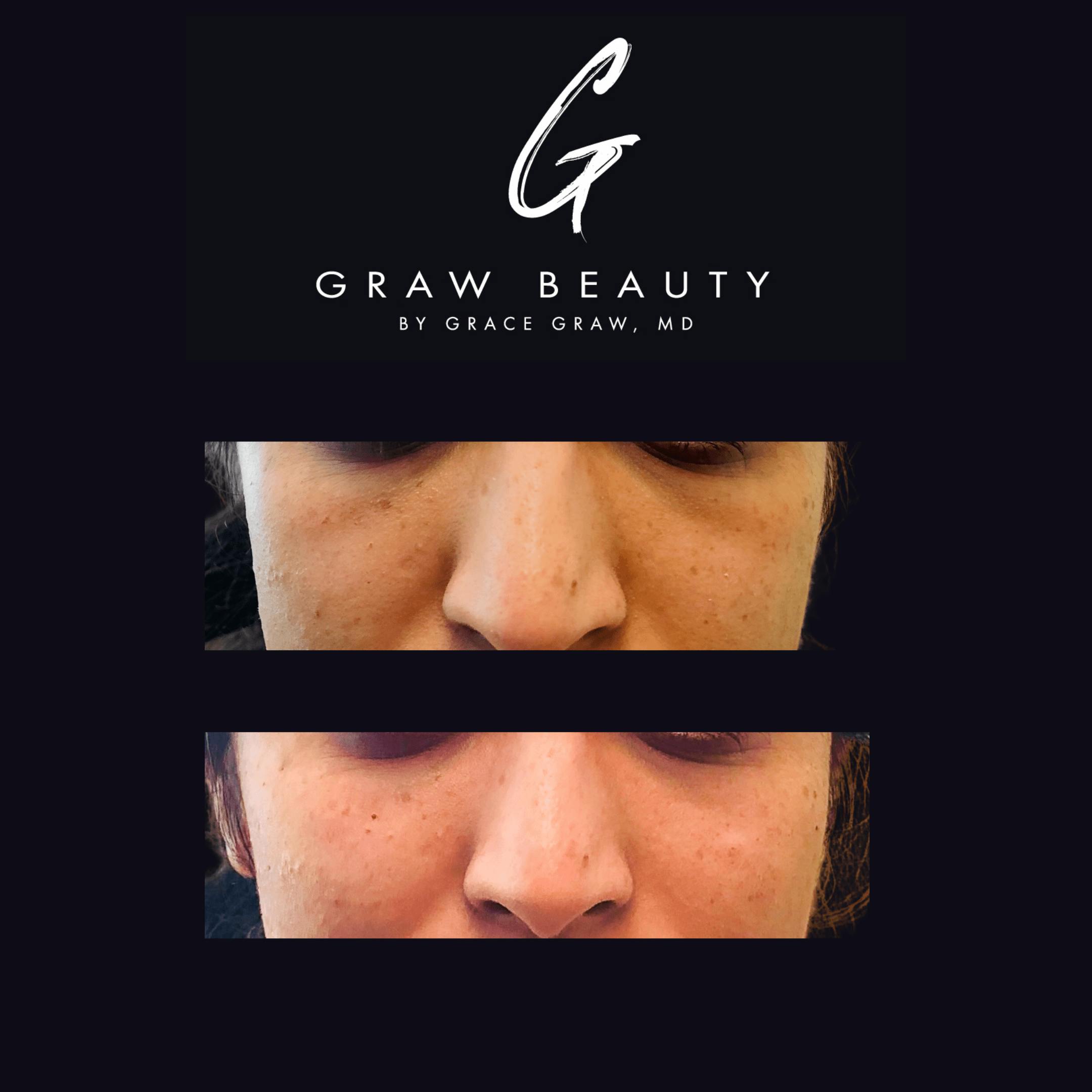 Face and Neck Before & After Gallery - Patient 122446367 - Image 1