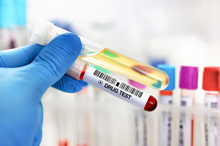 Best Buy Drug Test Policy 2024 Pre-employment Drug Testing in Canada: An Employer’s Guide