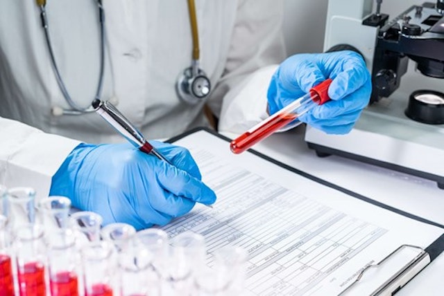 Can I test my employees for drugs?