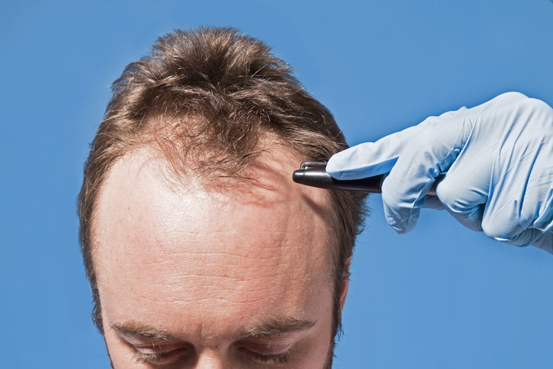 Finasteride 84 prix