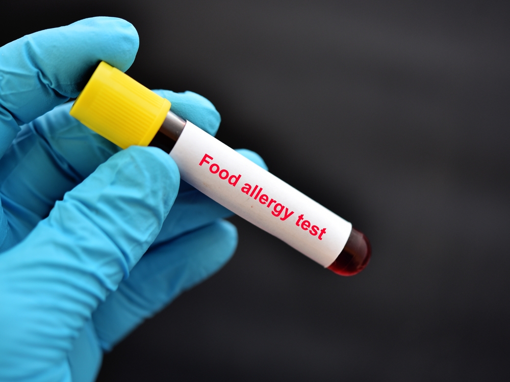 Complete Guide to Food Allergy Tests & Intolerance Tests