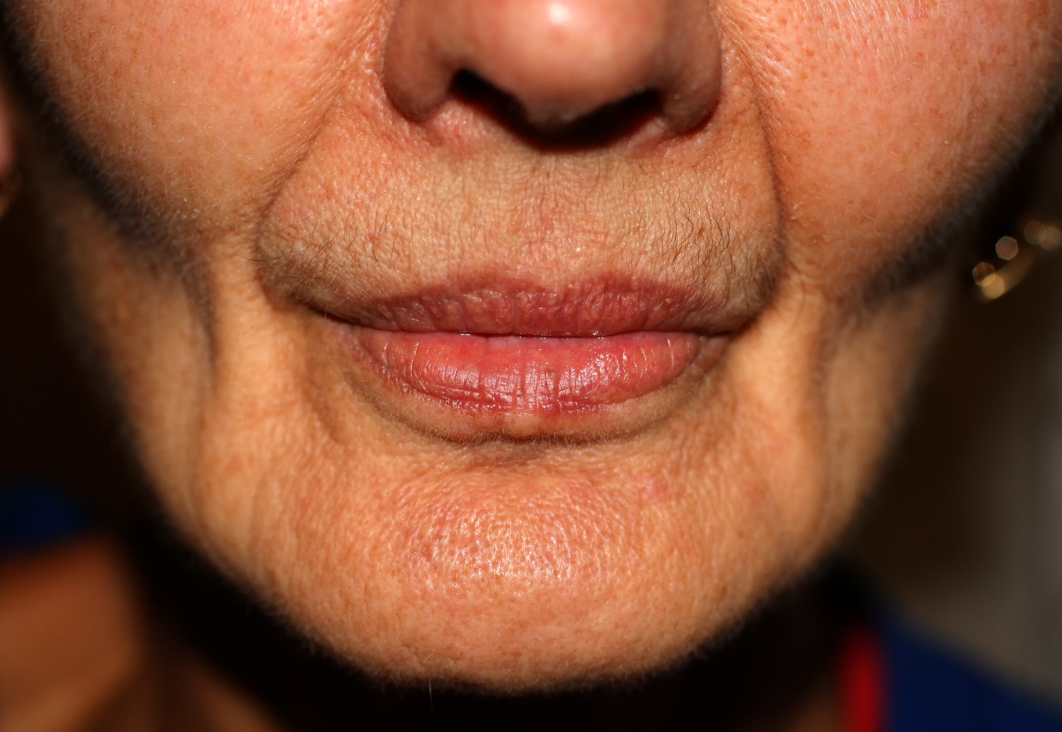 semaglutide feel sick How Long Do Semaglutide Side Effects Last?
