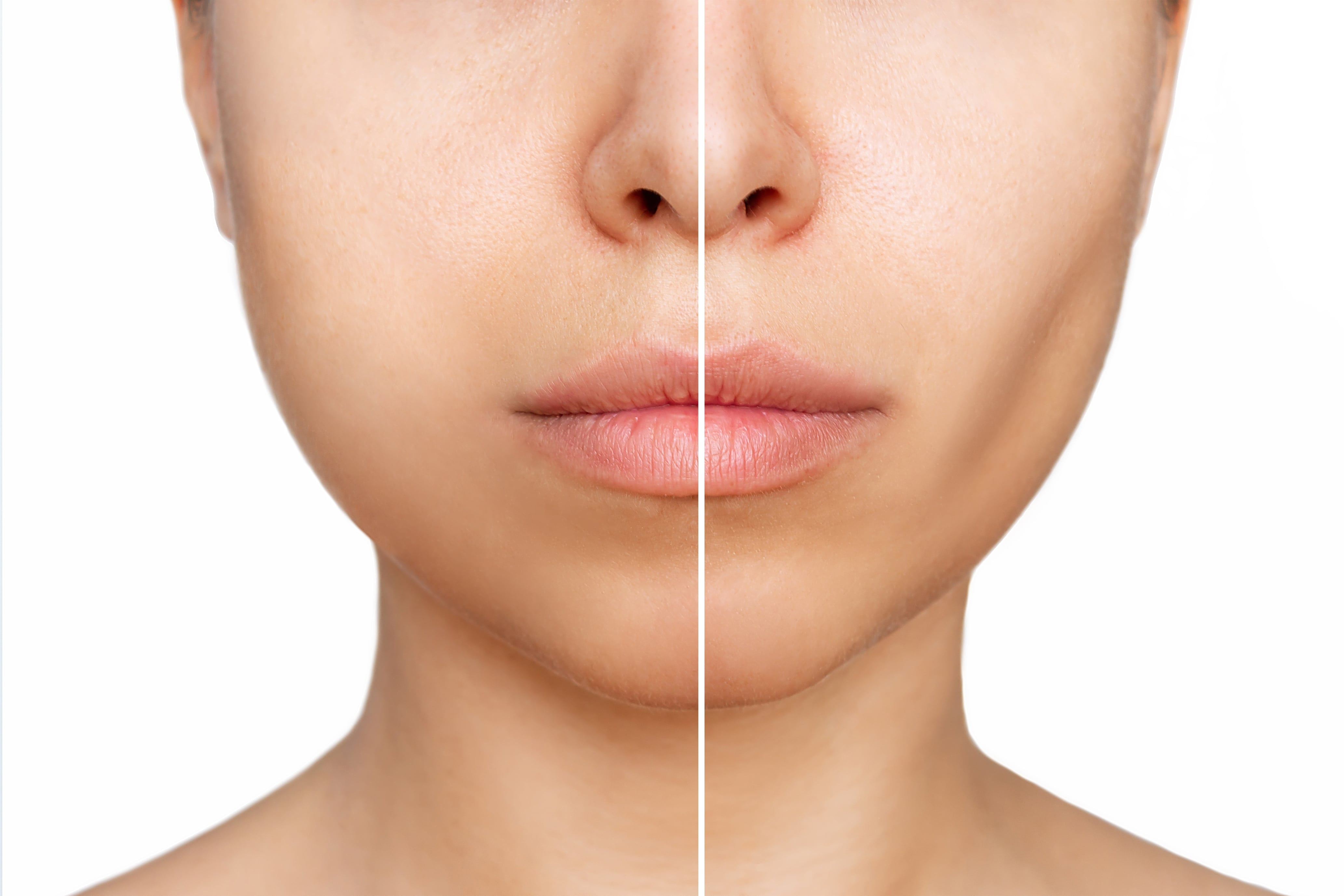 tirzepatide for the treatment of obstructive sleep apnea and obesity How effective is Zepbound (tirzepatide) for the treatment of obstructive sleep apnea?