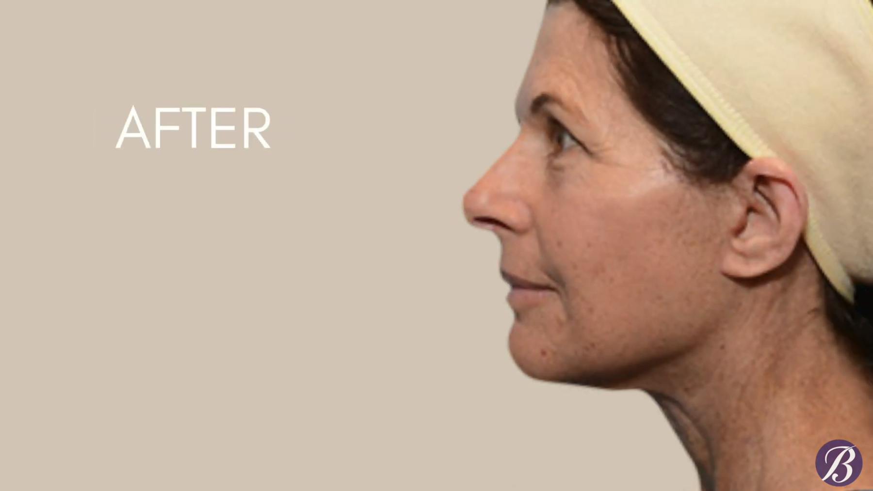 Beck Aesthetic Surgery