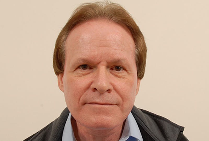 Neck Lift Before & After Gallery - Patient 363754 - Image 4