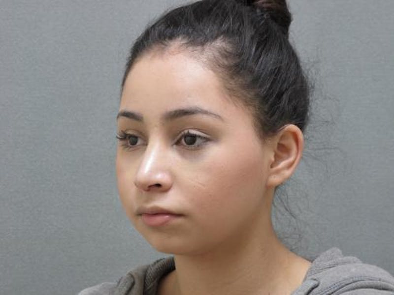 Rhinoplasty Before & After Gallery - Patient 120905429 - Image 8