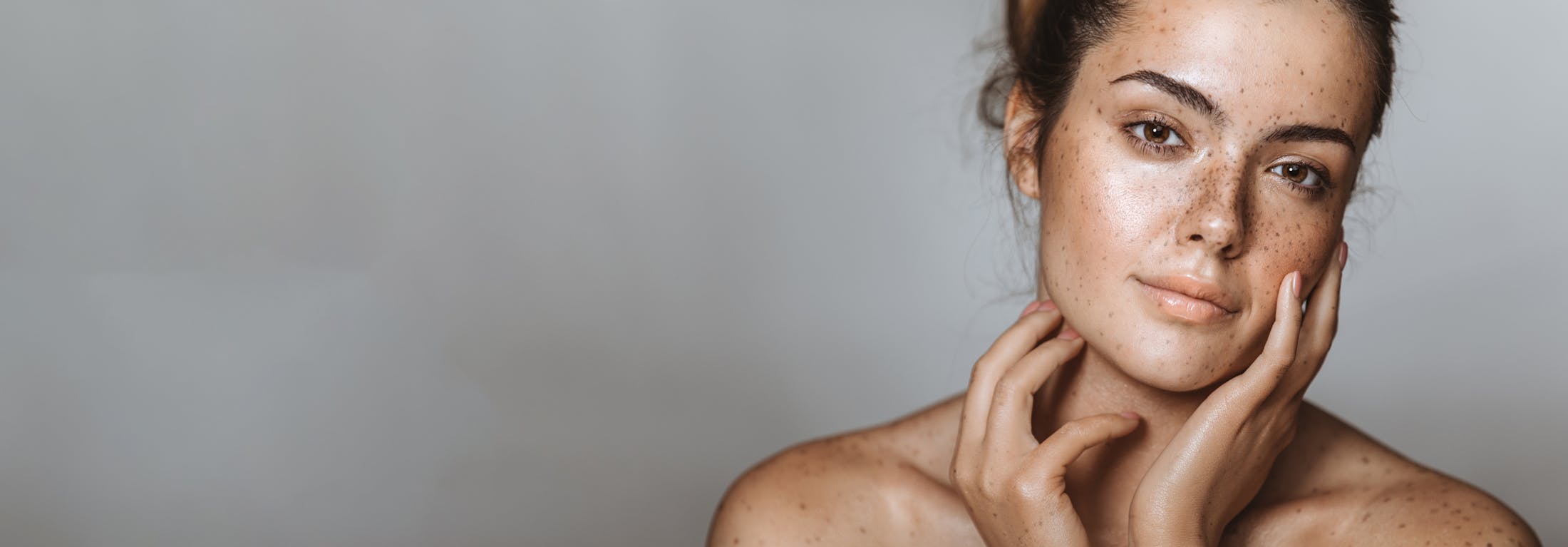 woman with freckles touching face