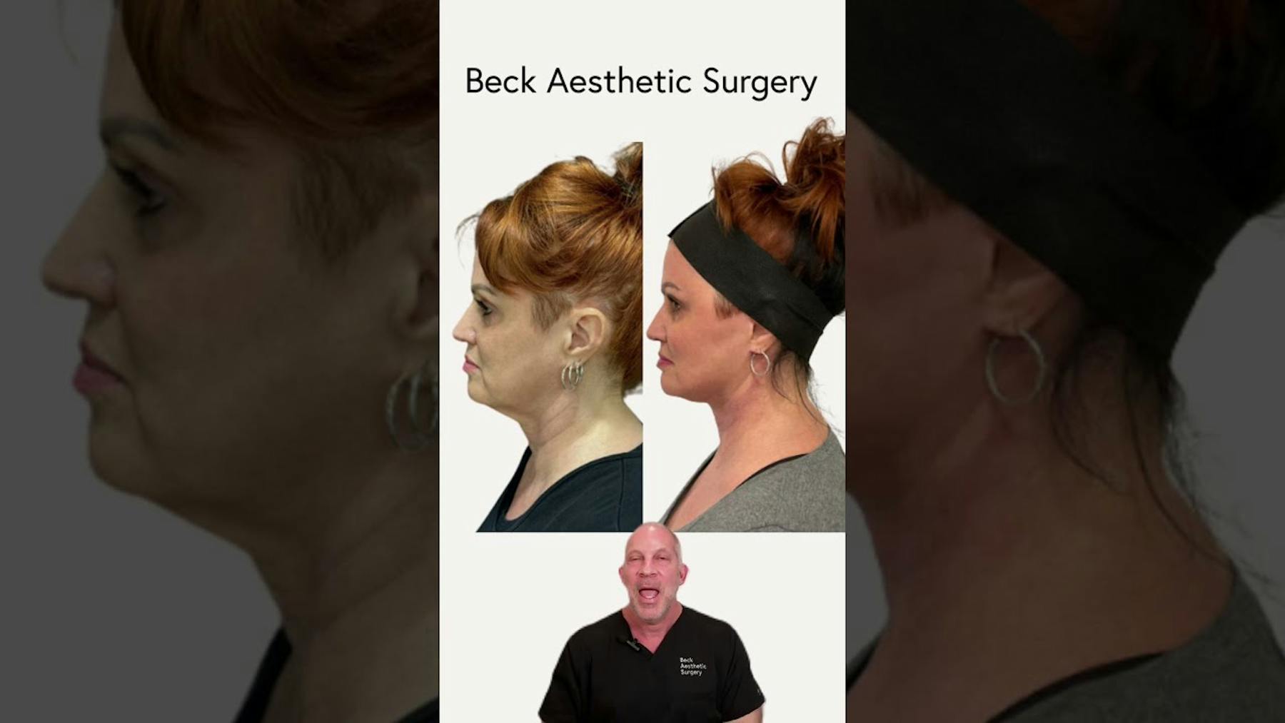 Beck Aesthetic Surgery