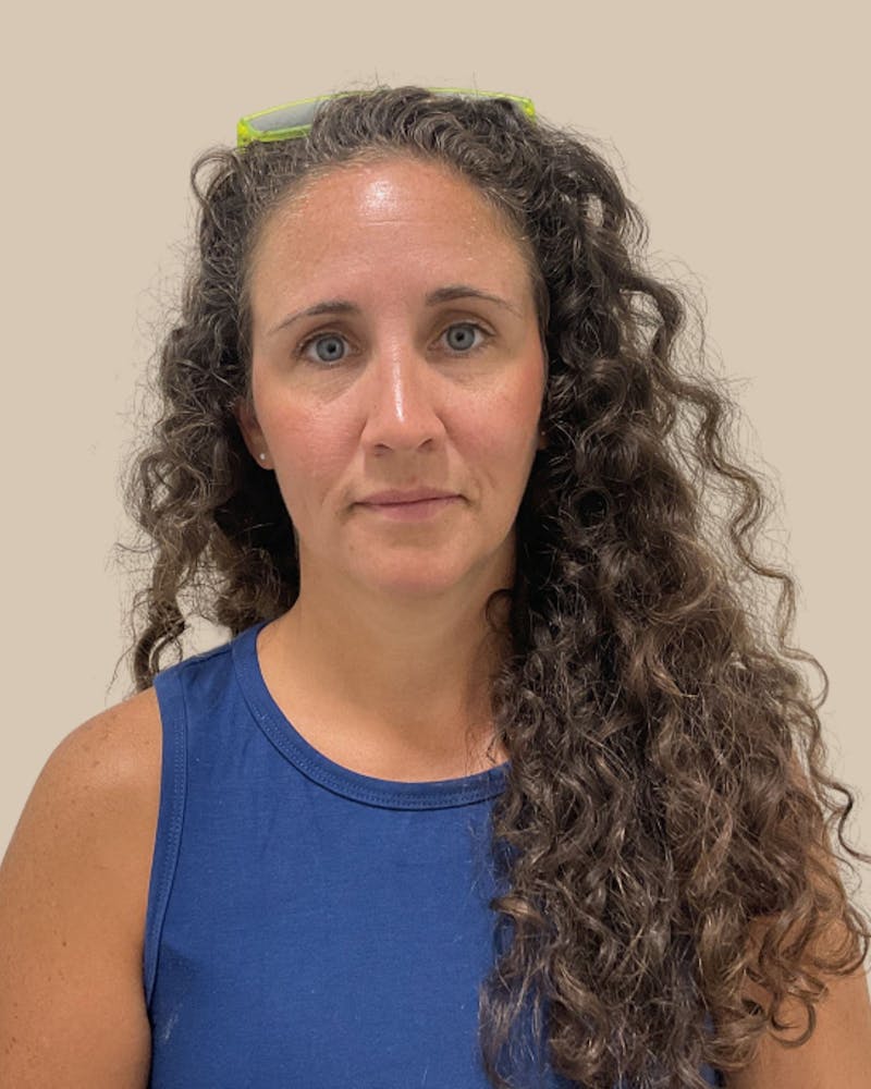 Injectables Before & After Gallery - Patient 411115 - Image 1