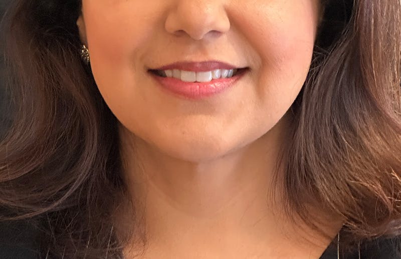 MyEllevate® Neck Lift