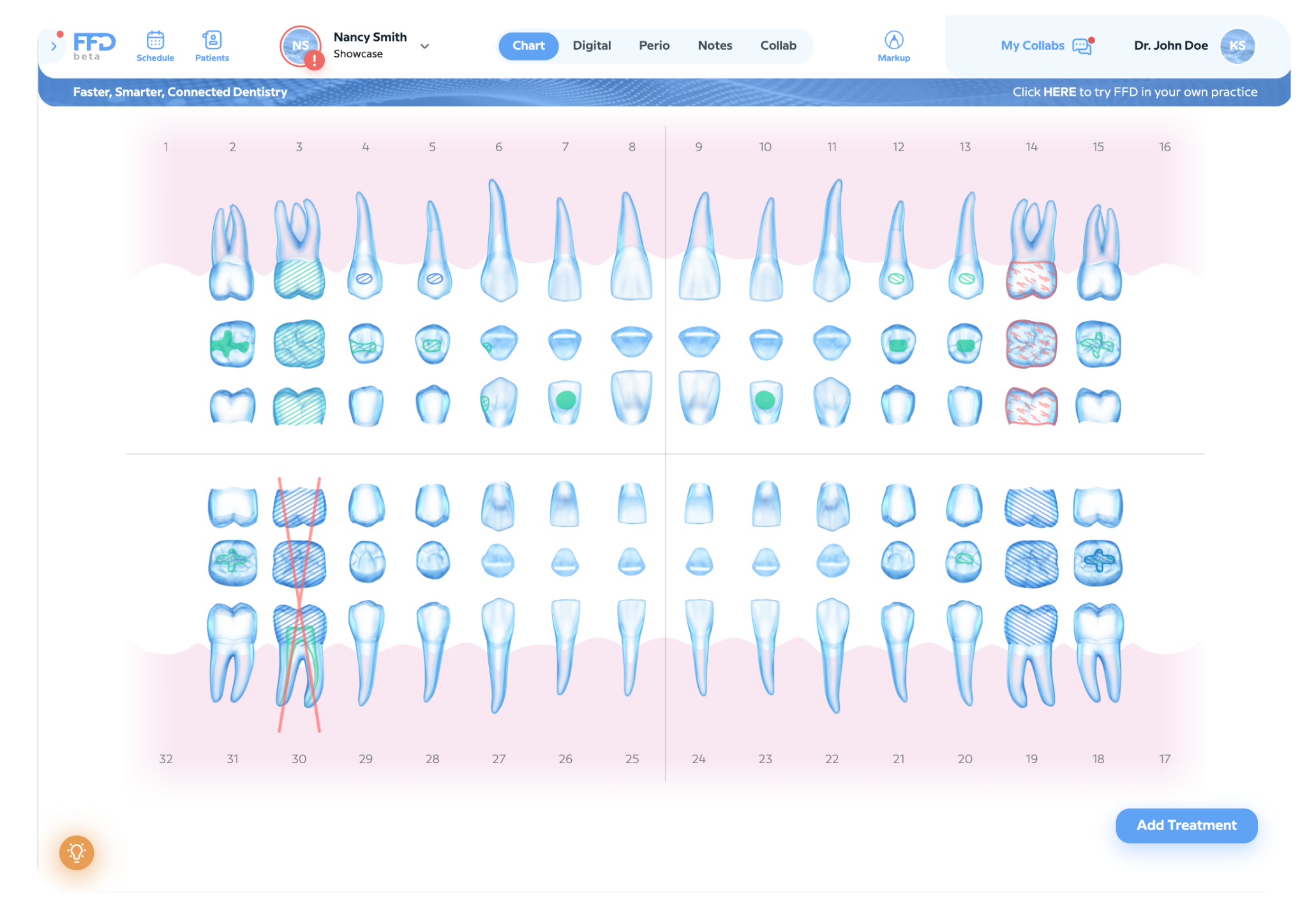 Image basic - narrow